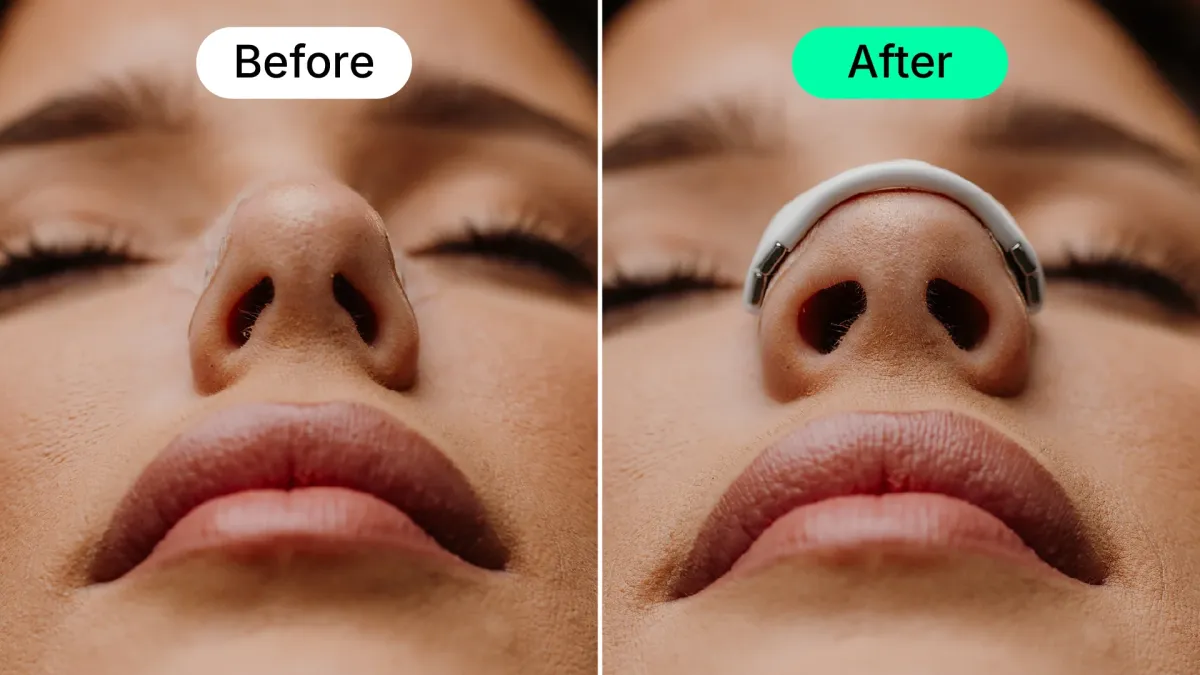 efek nasal strips.webp